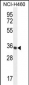 PRSS1 Antibody (Center)